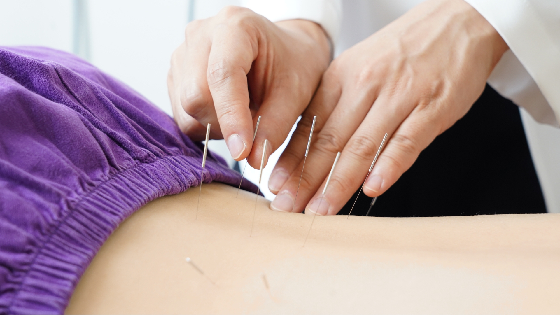 Acupuncture Services in Oshawa